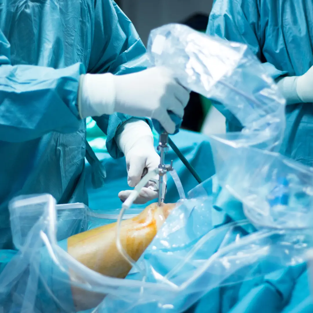 Arthroscopy Surgery in Vadodara